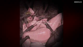 Preview at 00:11