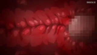 Preview at 00:19