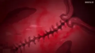 Preview at 00:20