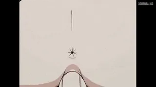 Preview at 00:10